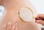 皮肤高度过敏也要学会保湿 皮肤高度过敏注意防晒（皮肤过敏保湿重要吗）