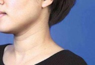 不让颈纹出卖年龄 锻炼颈部肌肉让自己更年轻（锻炼颈部肌肉可以减少颈纹吗）