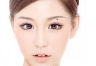 激光能够去除3种类型的痣（激光能去哪些痣）