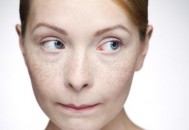 脸上出现雀斑给女性带来困扰 养颜祛斑的食疗方（脸上雀斑吃什么调理）