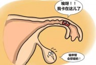 输卵管妊娠的自我检查、症状及治疗方法（输卵管妊娠的自我检查,症状及治疗方法是）