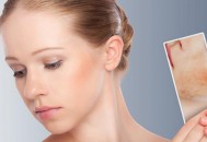 干性皮肤正确使用保湿面膜 干性皮肤日常注意事项（干性皮肤敷面膜的步骤是怎么样的）