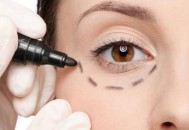 祛除眼袋小方子大推荐 让你今夏眼袋全无年轻十岁（去除眼袋小偏方有哪些）