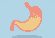 导致胃酸过多的原因有哪些（导致胃酸过多的原因有哪些症状）