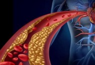 血液粘稠身体会出现的信号 血液粘稠饮食控制总原则（血液粘稠饮食怎么调理）