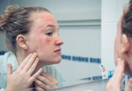 皮肤高度过敏选择微酸性洁面 皮肤高度过敏注意事项（微酸性洗面奶）