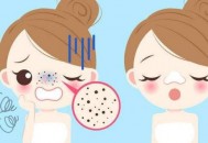 恼人的草莓鼻 教你有效更快祛除黑头的秘籍（怎样去除草莓鼻黑头）