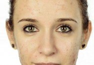 皮肤出油是缺水吗？皮肤出油怎么办