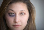 黑眼圈不仅是因为肾虚 黑眼圈透露你身体的健康问题（黑眼圈是不是肾虚?中医告诉你真相）