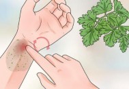 身体出现淤青的鬼捏青 应科学的找找出现的原因（淤青是鬼捏的吗）