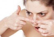 鼻翼两侧长痘 鼻痘的去除方法（鼻翼两侧长痘 鼻痘的去除方法图片）