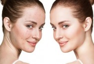 脸部经常出油的人更不健康 护理油性肌肤有妙招（脸部经常出油是什么皮肤）