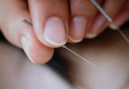 针灸美容帮你内外调节肌肤（针灸美容帮你内外调节肌肤吗）