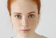 内外兼治祛除黄褐斑 去除黄褐斑食疗方法（祛除黄褐斑的食疗方法）