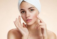 脸上反复长痘痘的原因 痤疮的食疗饮食方推荐（脸上起很多痤疮吃什么膳食调理好）