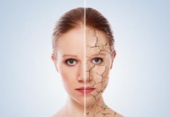 皮肤干燥脱皮帮你搞定它 即刻治愈脱皮护理篇（皮肤脱皮干燥用什么护肤品）