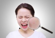 是否你的脸上长痘痘迟迟不消 小心这是粉瘤来袭（脸上长痘痘粉刺是病吗）