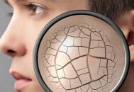 冬天皮肤干燥起皮原因及缓解方法 冬季美容护肤食物（冬天皮肤干燥起皮怎么办?）