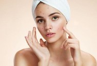 对祛痘有辅助作用的食物推荐 正确的日常护理很重要（利于祛痘的食物）