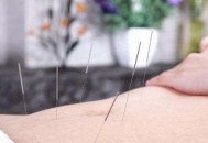 针灸美容内外调养更美颜（针灸美容方法）