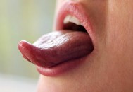 舌苔又黄又厚并非健康的舌头 舌苔黄厚的饮食疗方（舌苔厚黄怎么食疗方法）