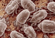 螨虫一生都在啃你的毛孔 说明中招螨虫的迹象揭秘（螨虫啃食皮肤）