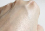 神经性皮炎的症状及病因有哪些（神经性皮炎的症状及病因有哪些图片）